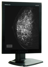 威強工業電腦推出高分辨率診斷級醫療顯示器