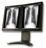 IEI威強工業電腦推出高分辨率診斷級醫療顯示器